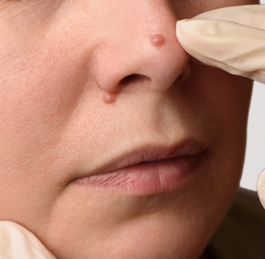 a close up of a person