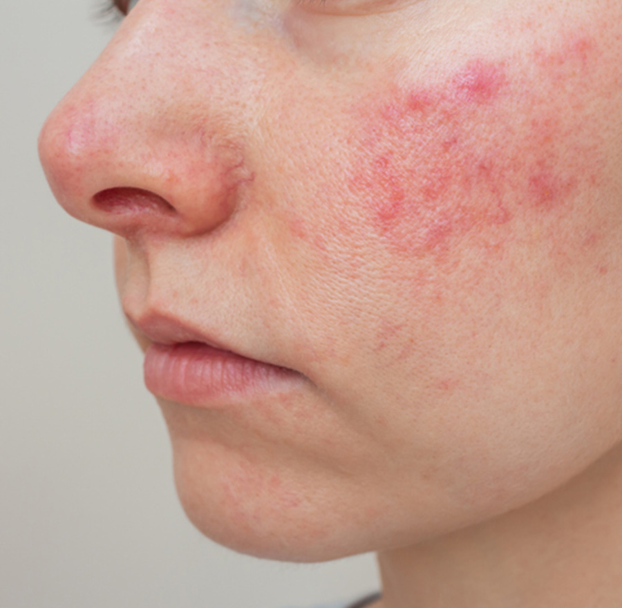 a close up of a person